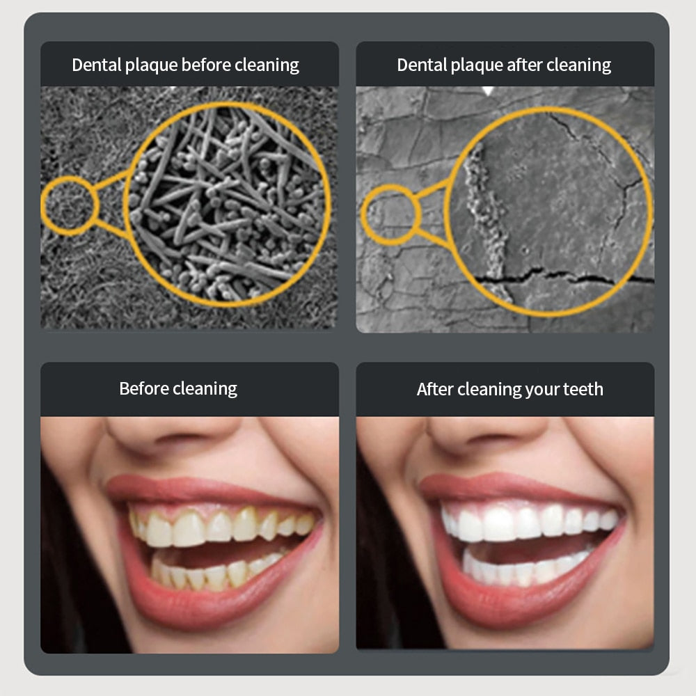 Electric Sonic Dental Calculus Scaler Oral Teeth Irrigator Calculus Remover Plaque Stains Cleaner Teeth Whitening LED Display