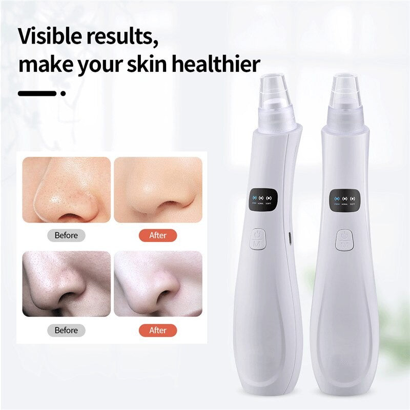 Blackhead Remover Face Nose Deep Cleaner Pore Acne Pimple Removal Vacuum Suction Facial Diamond Beauty Clean Skin Tool