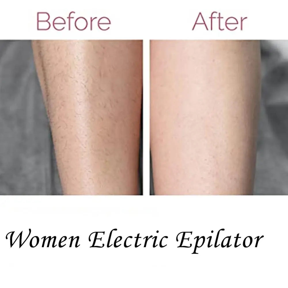 Painless Electric Shaver For Women Legs Rechargeable Hair Removal Female Shaving Machine Underarm Lady Electric Razor For Body