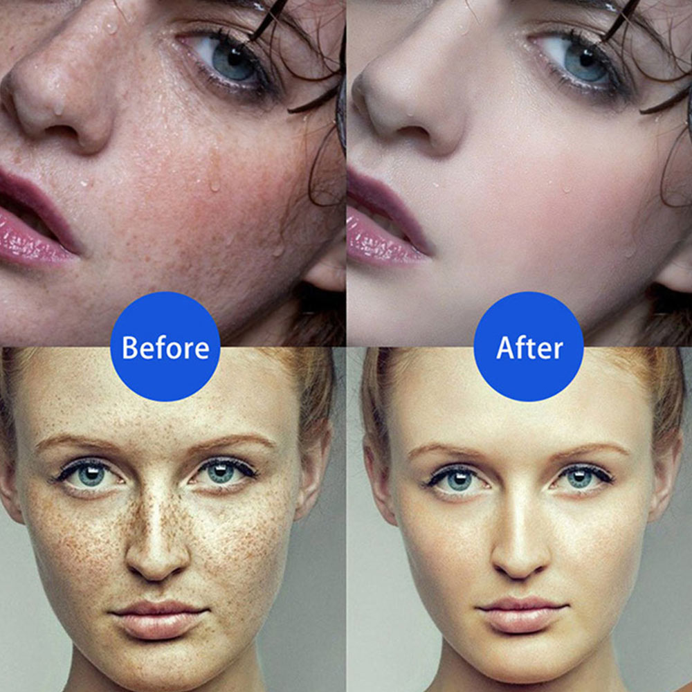 Electric Plasma Jet Pen Freckle Remover Machine Mole Removal Dark Spot Remover Skin Wart Tag Tattoo Remaval Tools Beauty