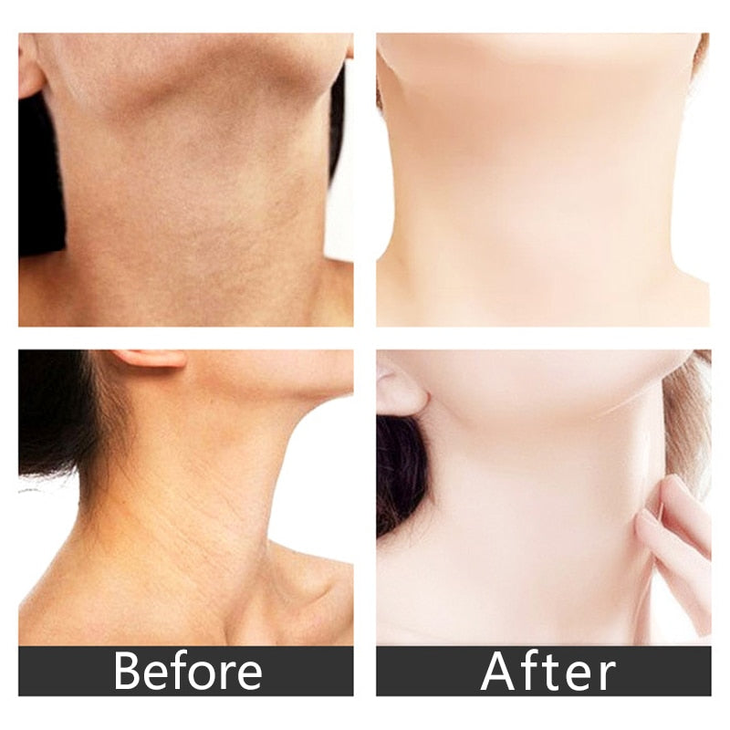 Neck Anti Wrinkle Face Lifting Beauty Device LED Photon Treatment Skin Care EMS Tighten Massager Reduce Double Chin Wrinkle Removal