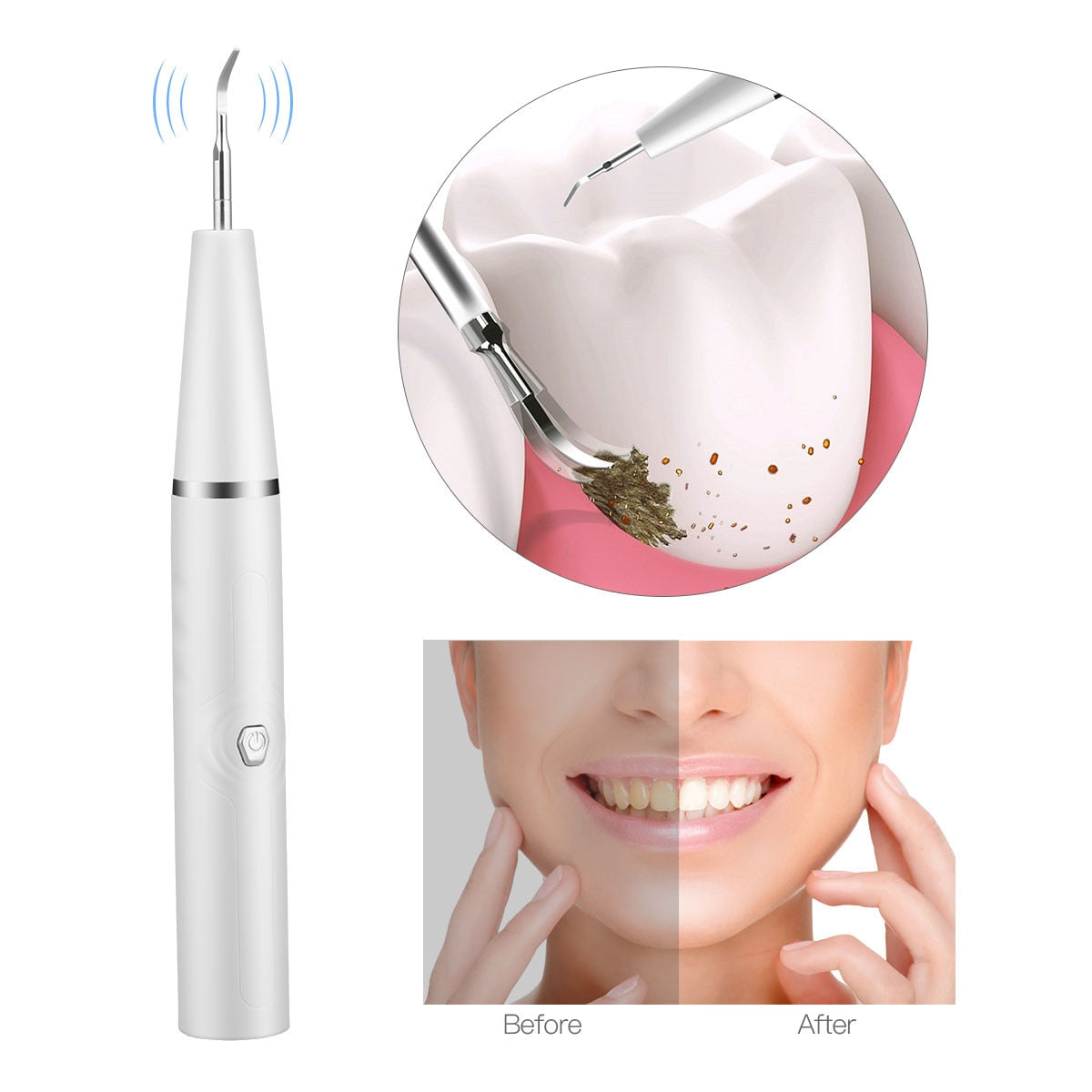 Electric Ultrasonic Sonic Dental Scaler Waterproof Tooth Calculus Tartar Remover USB charging Whiten Teeth Cleaner Tools