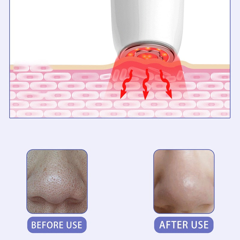 6 In 1 RF Face Massager Skin Rejuvenation Facial Lifting Beauty Vibration Wrinkle Removal Anti Aging Radio Frequency