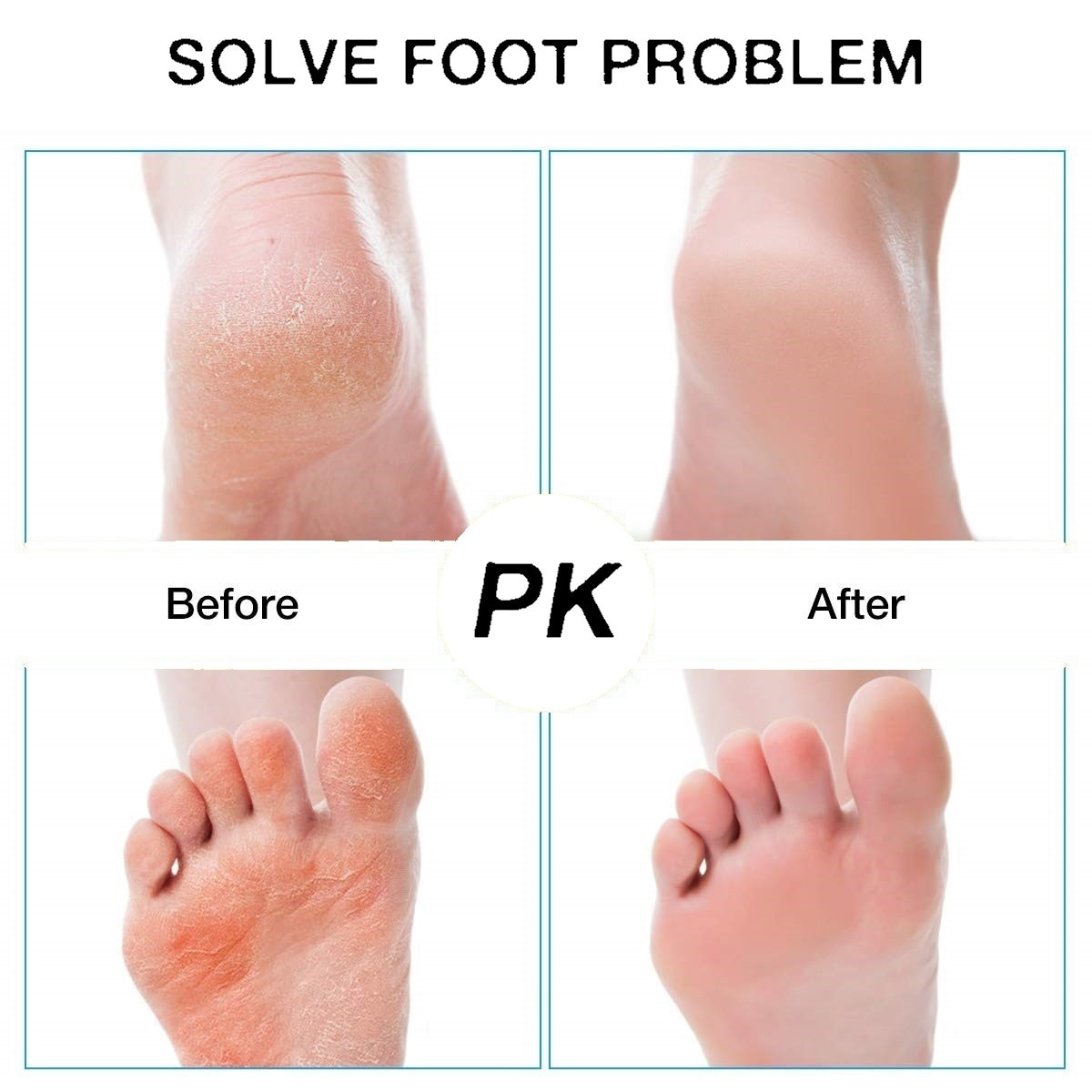 Foot Care Tool with 3 Rollers Skin Care Feet Dead Dry Skin Remover Electric Foot File Callus Remover for Cracked Heels Cuticles