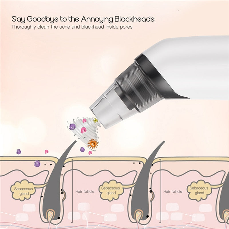 4 In 1 Blackhead Remover Rechargeable Vacuum Suction Warmer Blackhead Acne Comedo Extractor Facial Cleanser Beauty Machine