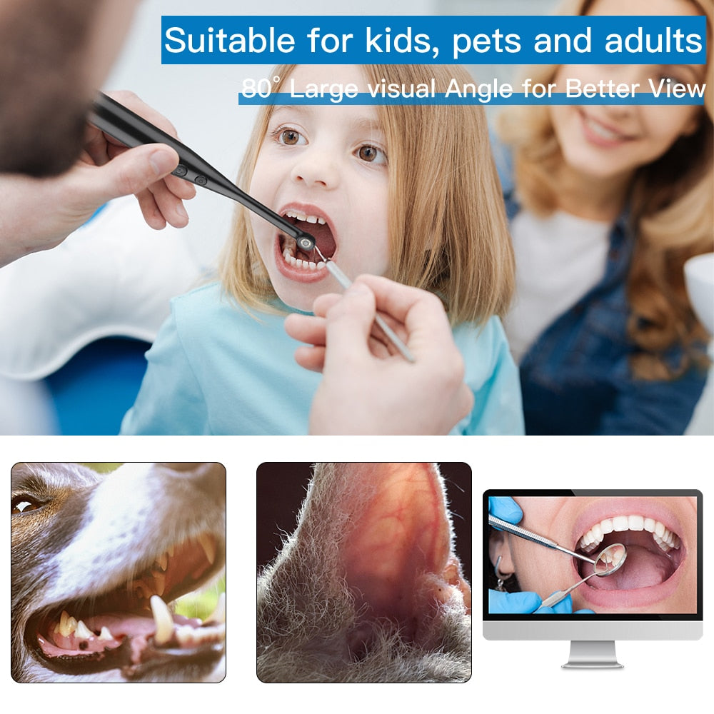 Intraoral Dental Camera Endoscope 720P HD Oral Dental Camera Adjustable 6 LED Light IP67 USB Tooth Camera for PC Laptop Computer