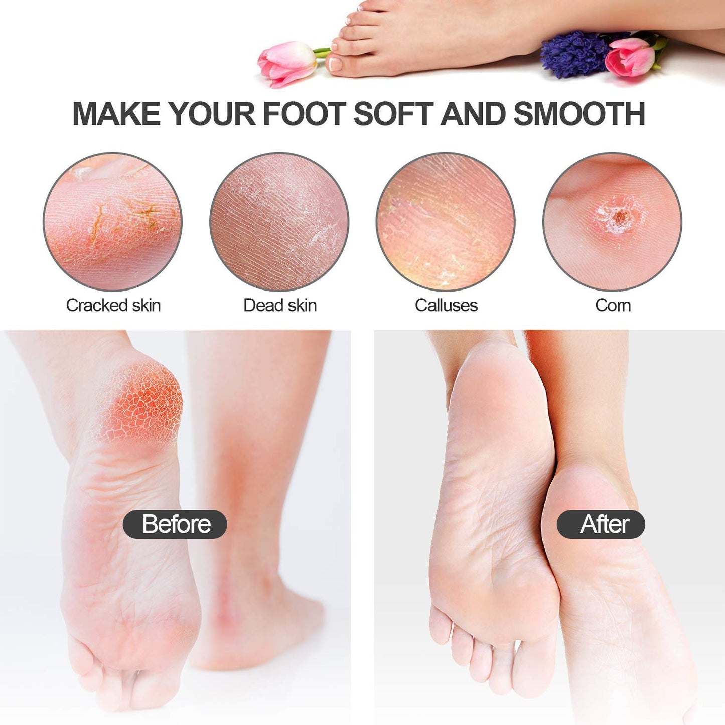 Pedicure Kit 20 in 1 Black Stainless Steel Professional Pedicure Tools Set Foot Rasp Peel Callus Dead Skin Remover Foot Care