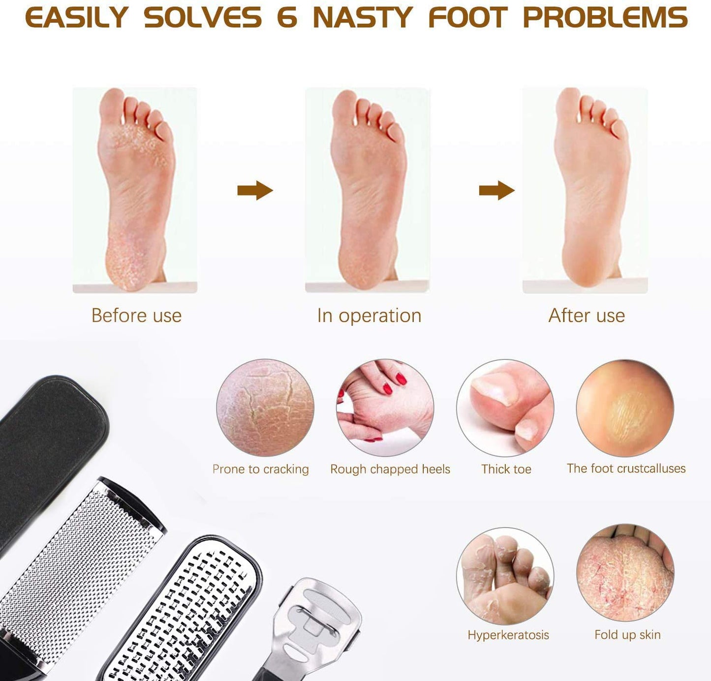 Foot Care Set Pedicure Set Professional Stainless Steel Nail Clipper Callus Remover Manicure Set Foot Care Set for Women Men