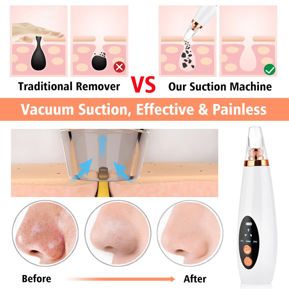 Facial Pore Cleaner Blackhead Remover Vacuum Suction Cleaner Pore Acne Pimple Extractor Removal Device Skin Care Beauty Tool