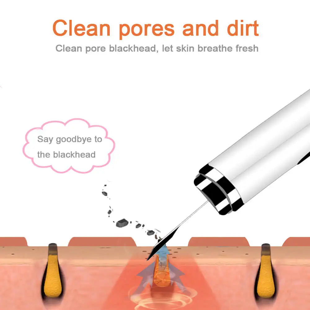 Ultrasonic Skin Scrubber Deep Face Cleaning Vibration Blackhead Remover Peeling Shovel Clean Pore Reduce Wrinkles Beauty Device