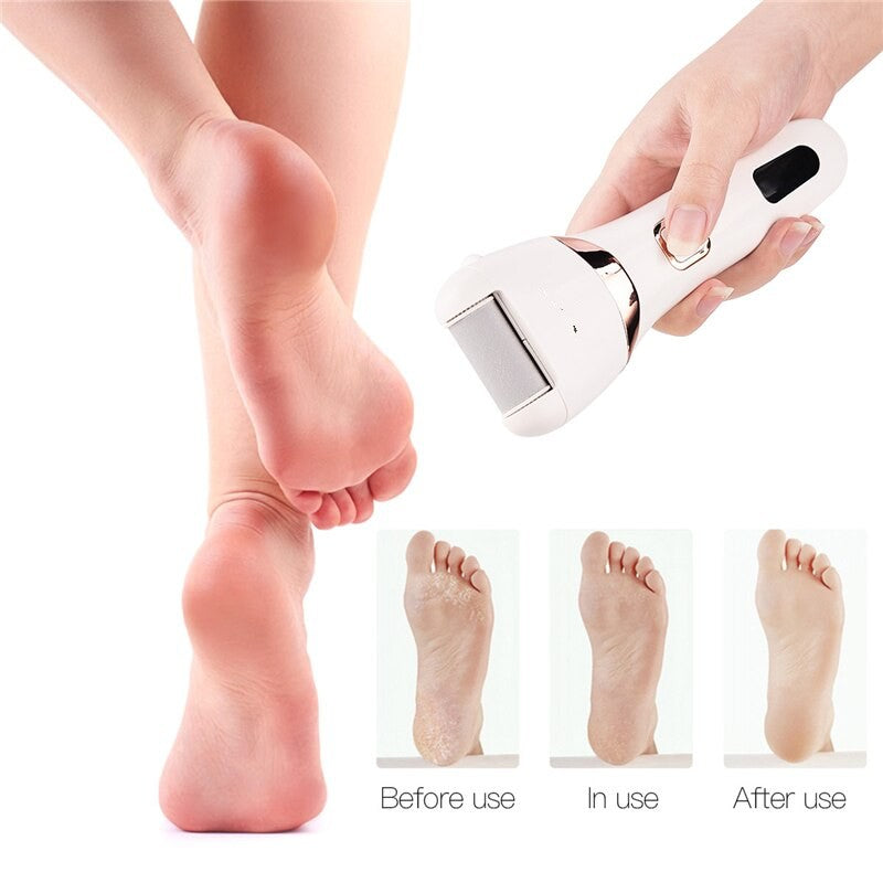 Electric Pedicure Foot Care Tool Files Pedicure Callus Remover Rechargeable Sawing File For Feet Dead Skin Callus Peel Remover
