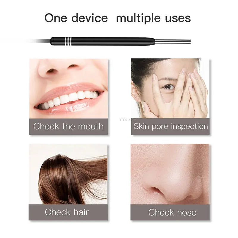3 In 1 3.9mm Ear Spoon Visual Endoscope Mini Camera HD Video Photographic Lumious Nose USB Otoscope for Android OTG UVC Phone