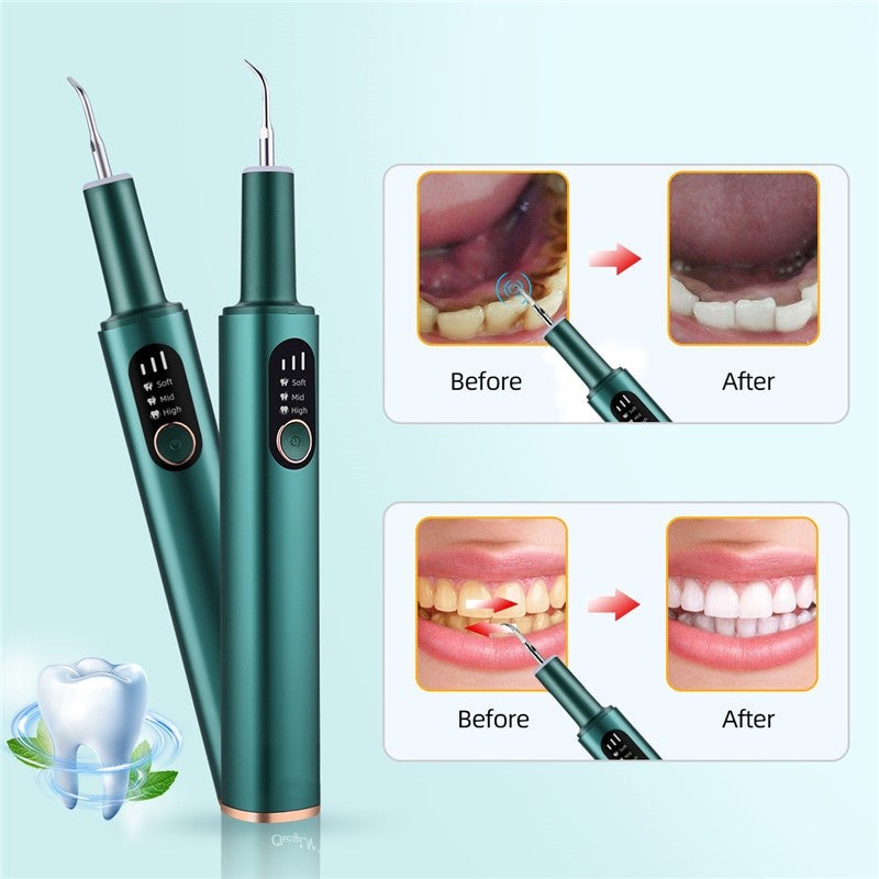 Portable Electric Sonic Dental Calculus Scaler Oral Teeth Tartar Remover Plaque Stains Cleaner Removal Teeth Whitening