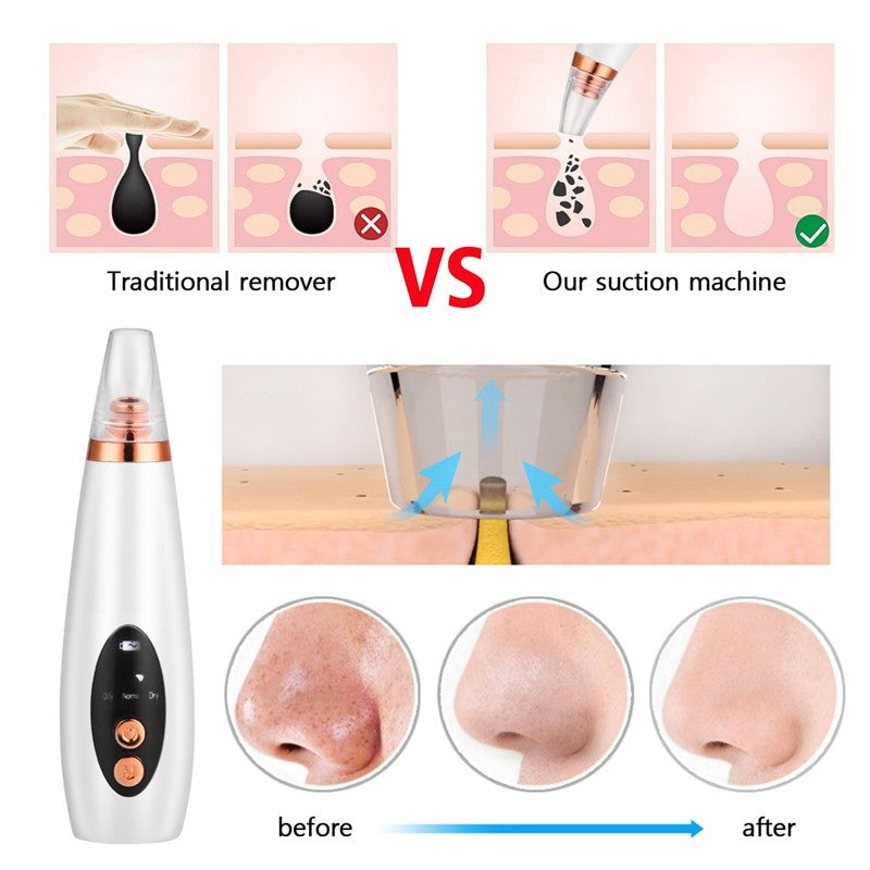 6 In 1 Electric Facial Blackhead Remover Vacuum Suction Pore Removal Deep Cleaning Face Cleanser Household Beauty Tools