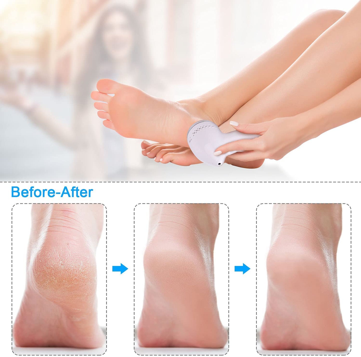 Portable Electric Grinder Pedicure Tools Foot Heel Care Tool Pedicura Velvet Smooth Machine Callus Remover for Foot Heel Skin