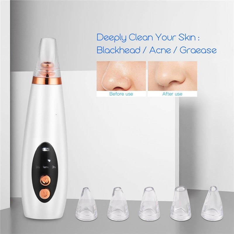 6 In 1 Electric Facial Blackhead Remover Vacuum Suction Pore Removal Deep Cleaning Face Cleanser +Nano Facial Steamer Sprayer