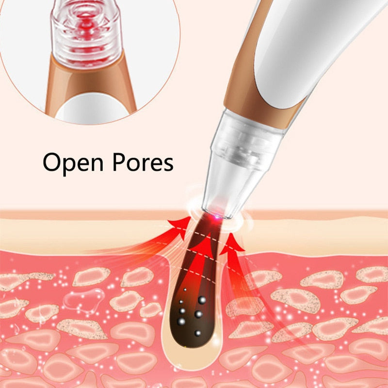 Electric Blackhead Remover Black Head Vacuum Pore Cleaner Heating Vacuum Suction Diamond T Zone Pimple Removal Beauty Device