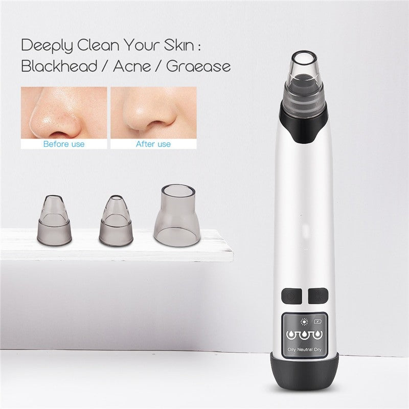 4 In 1 Blackhead Remover Rechargeable Vacuum Suction Warmer Blackhead Acne Comedo Extractor Facial Cleanser Beauty Machine