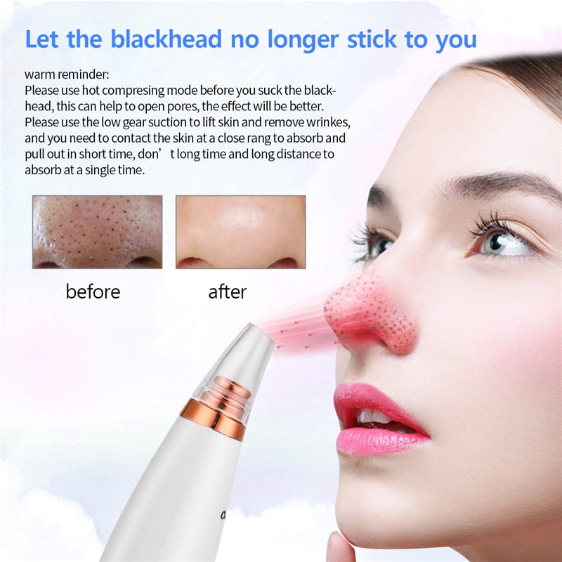 6 In 1 Electric Facial Blackhead Remover Vacuum Suction Pore Removal Deep Cleaning Face Cleanser Household Beauty Tools