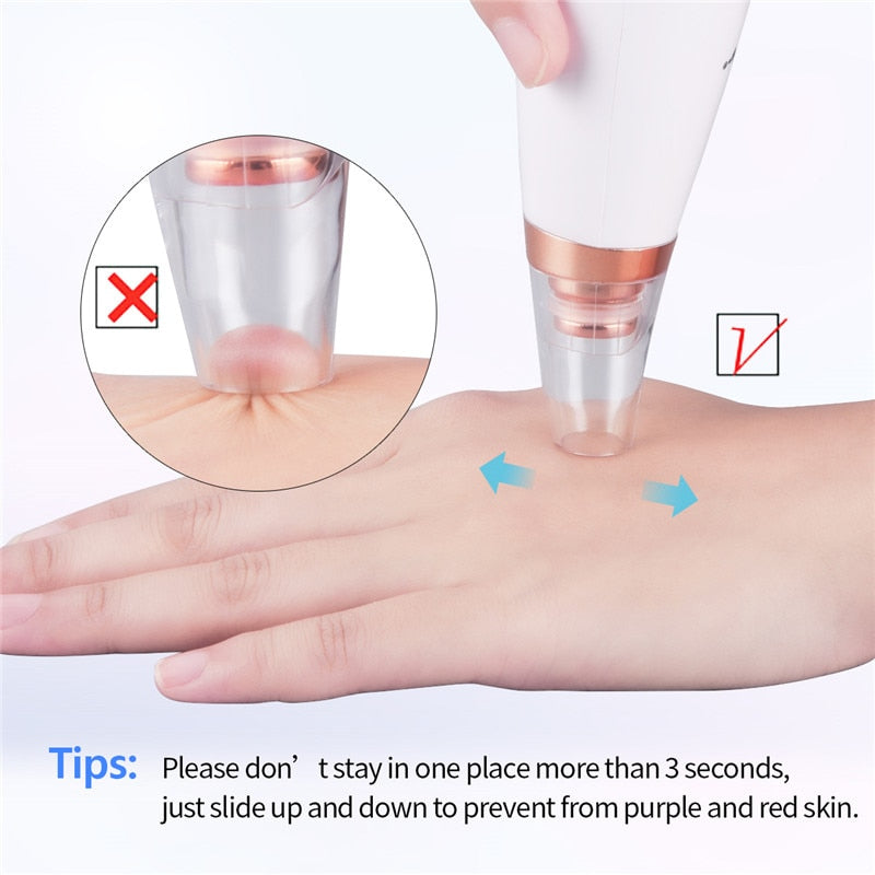 6 In 1 Electric Facial Blackhead Remover Vacuum Suction Pore Removal Deep Cleaning Face Cleanser Household Beauty Tools