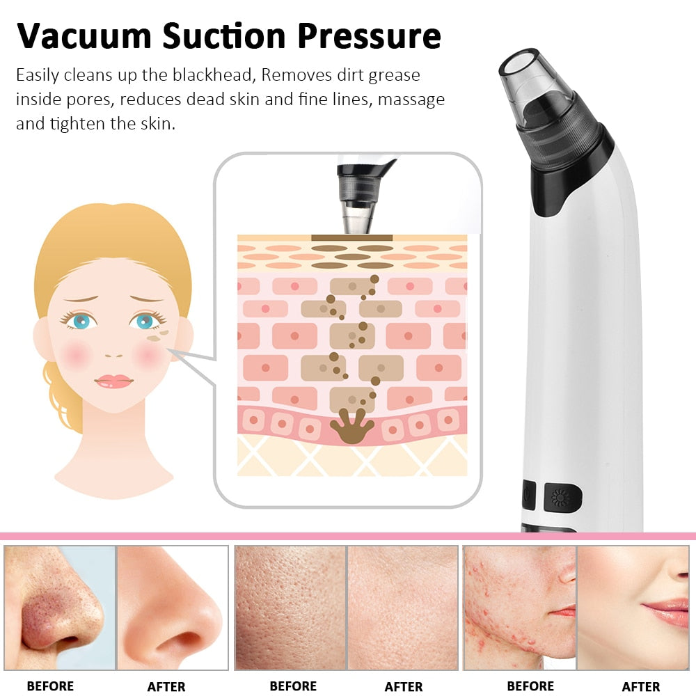 Nose Cleaner T Zone Pore Acne Pimple Removal Blackhead Remover Face Deep Vacuum Suction Facial Diamond Beauty Clean Skin Tool