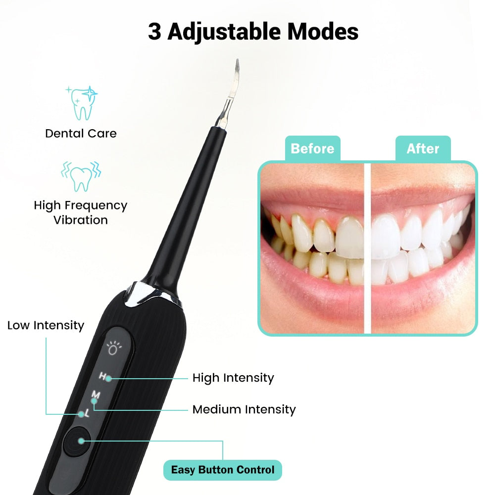 High Frequency Dental Teeth Whitening Electric Tooth Brush For Calculus Stains Scaler Teeth Tartar Remover Teeth Cleaning Tools