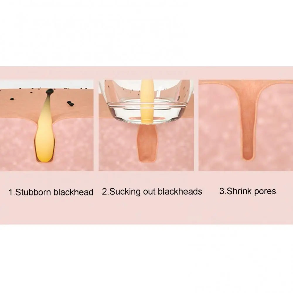 Blackhead Remover Pore Vacuum Cleaner Face Skin Care Sucker Rechargeable LCD Display Suction Spot Removal Tools Acne Remover