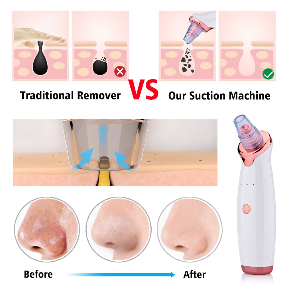 Facial Blackhead Remover Electric Acne Cleaner Blackhead Black Point Vacuum Cleaner Tool Black Spots Pore Cleaner Machine