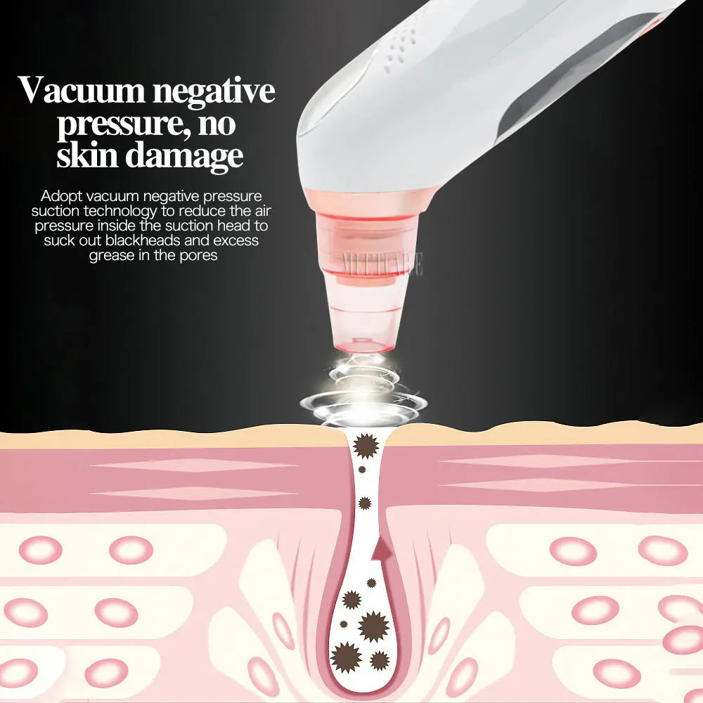 Vacuum Cleaner Blackhead Remover Heatable with Base Photon Rejuvenation Facial Cleaner Acne Pore Extractor Skin Tool