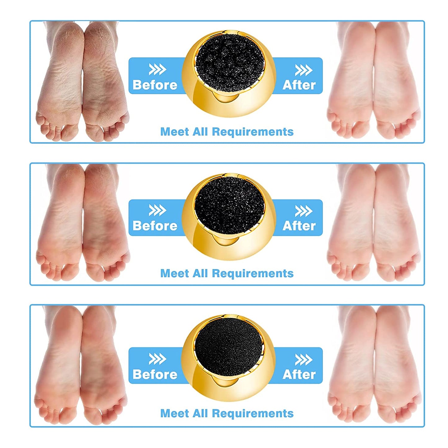 New Electric Pedicure Smooth Machine Callus Remover USB Charge Foot for Heels Grinder Files Absorbing Portable Clean Care