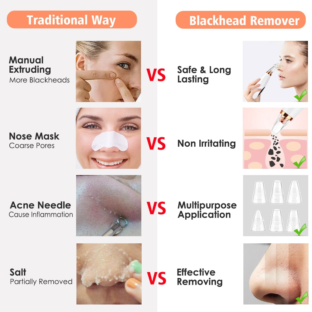 Facial Pore Cleaner Blackhead Remover Vacuum Suction Cleaner Pore Acne Pimple Extractor Removal Device Skin Care Beauty Tool