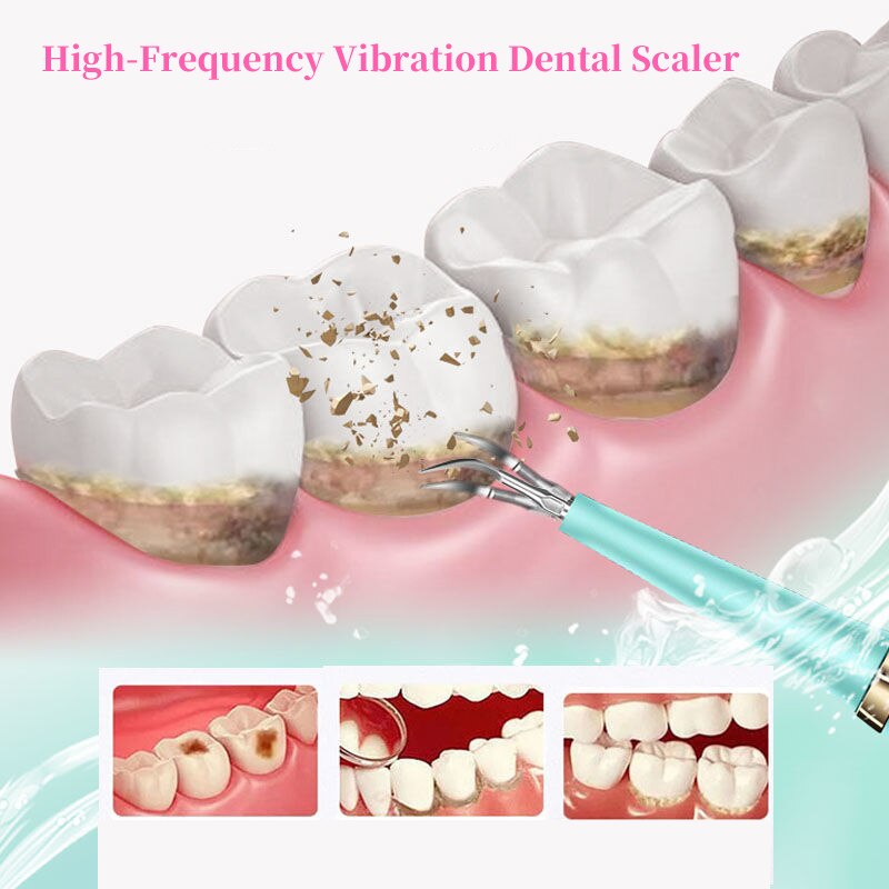 Portable Electric Sonic Dental Scaler Tooth Cleanser Dentist Calculus Stains Tartar Remover Teeth Whitening Tools Oral Hygiene