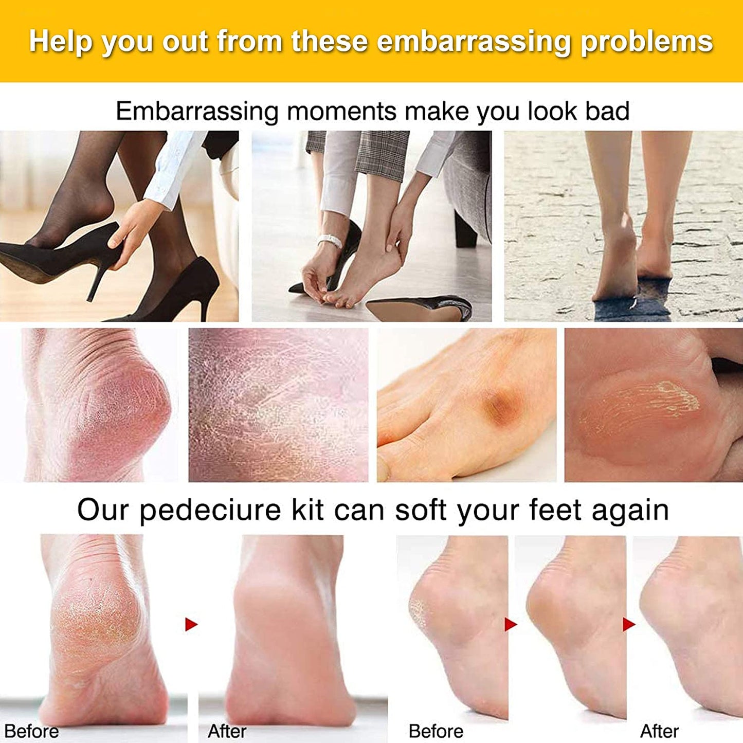 Foot Care Set Pedicure Set Professional Stainless Steel Nail Clipper Callus Remover Manicure Set Foot Care Set for Women Men