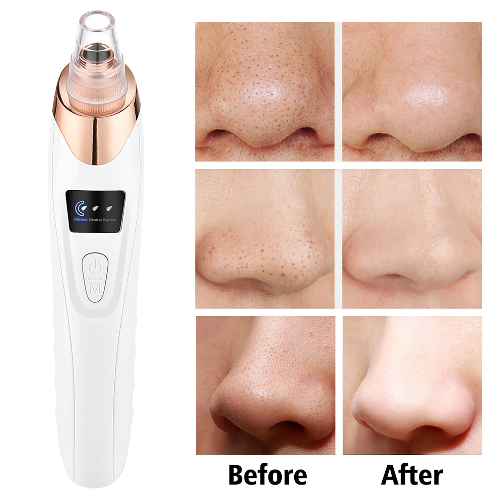 Electric Vacuum Suction Blackhead Remover Face Pore Vacuum Acne Pore Cleaner Pimple Removal Facial Skin Care Tools