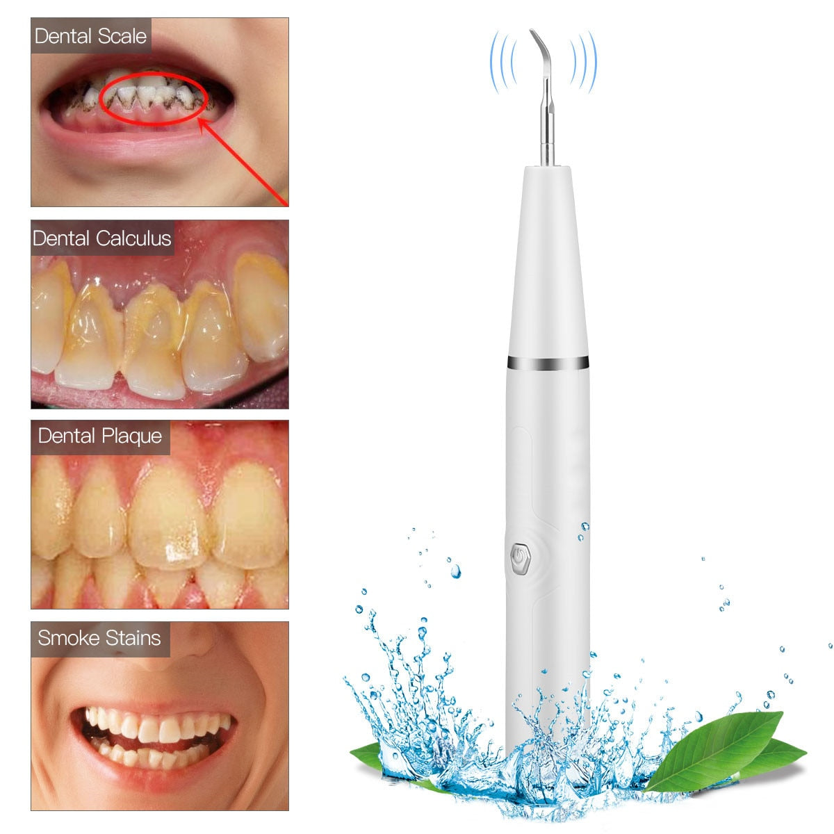 Electric Ultrasonic Sonic Dental Scaler Waterproof Tooth Calculus Tartar Remover USB charging Whiten Teeth Cleaner Tools