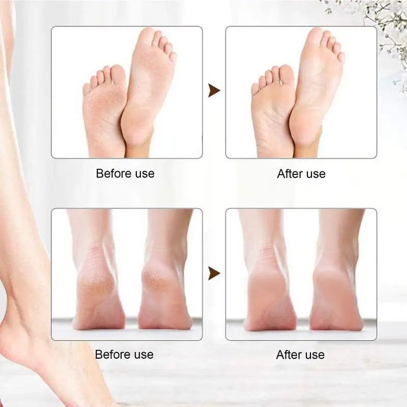 Rechargeable Foot Grinder USB Rechargeable Feet Callus Remover Foot Care Callus Remover With LED Indicator Light For Women Men