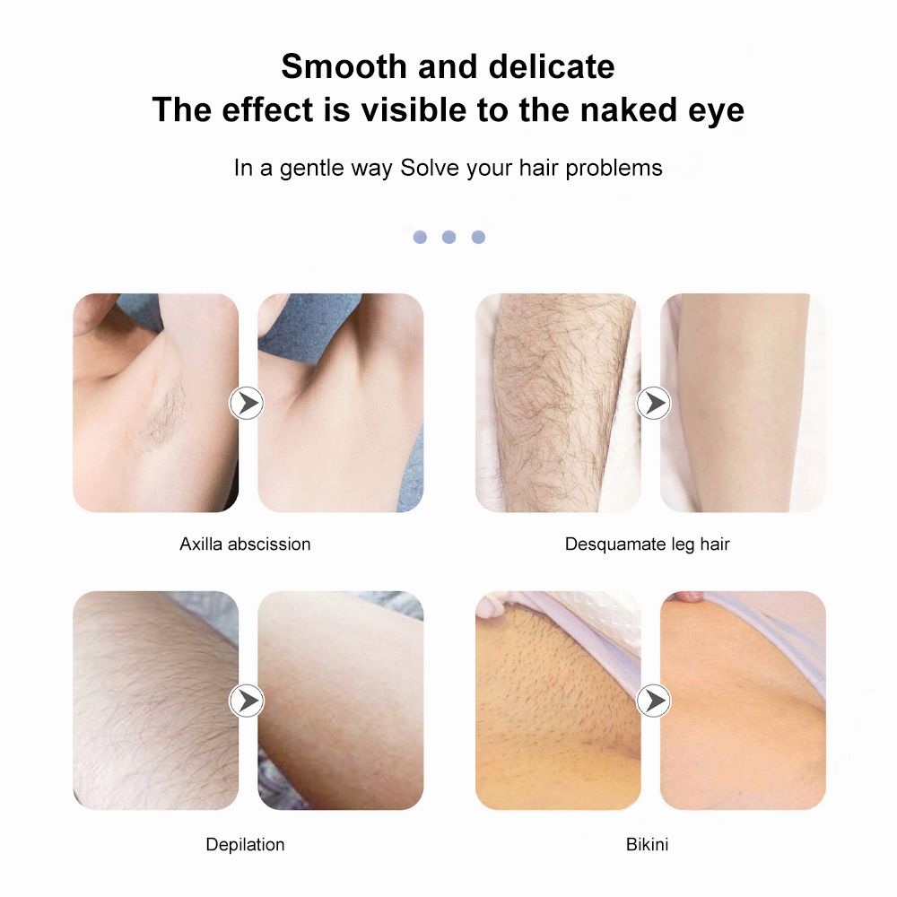 Electric Depilator Epilator Hair Remover Shaver Machine Bikini Body Facial Hair Removal Beard Razor Trimmer for Women Men