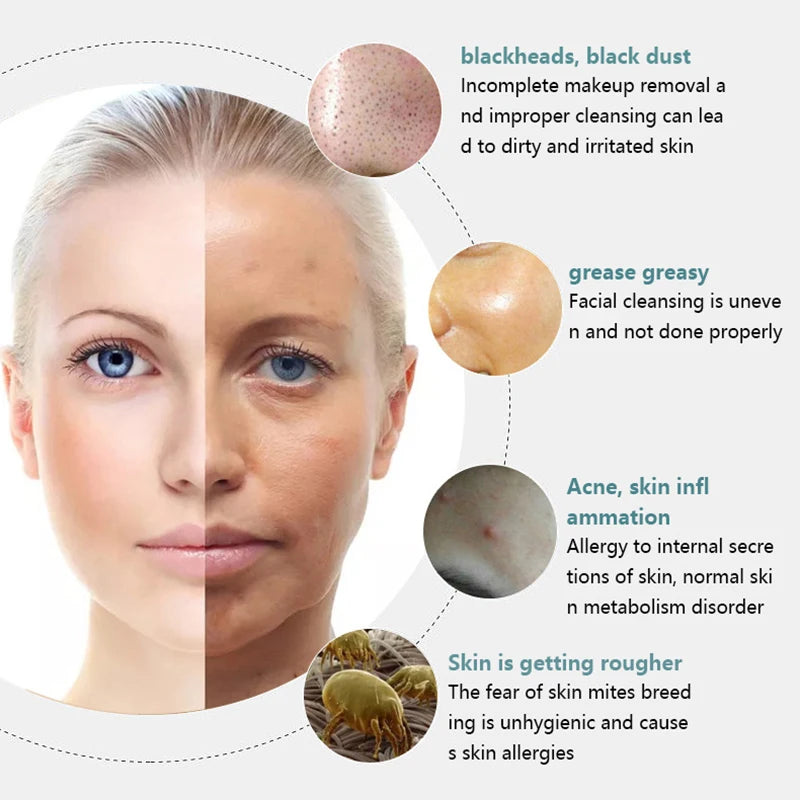 Electric Facial Cleansing Brush EMS Lifting and Introduction Massager Blackhead Removal and Pore Beauty Instrument Facial Skin Care