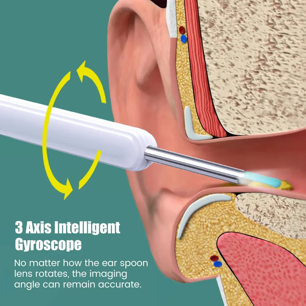 Wireless WiFi Ear Pick Otoscope Camera Borescope Luminous Ear Wax Cleaning Teeth Oral Endoscope Inspection Ear Cleaner Removal