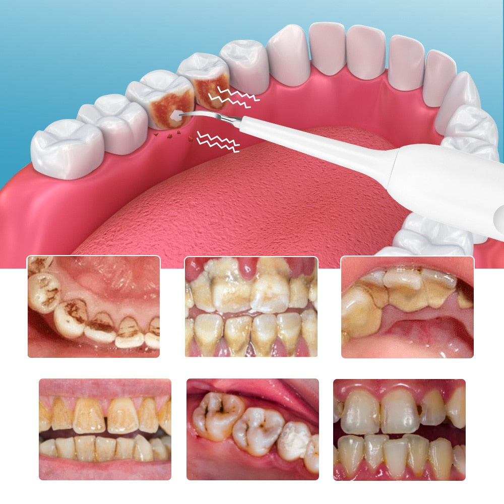 New Electric Sonic Tooth Cleaner Whitening Toothbrushes Dental Scaler Tartar Remover for Adults 3 Mode Smart Timer Teeth Brushes