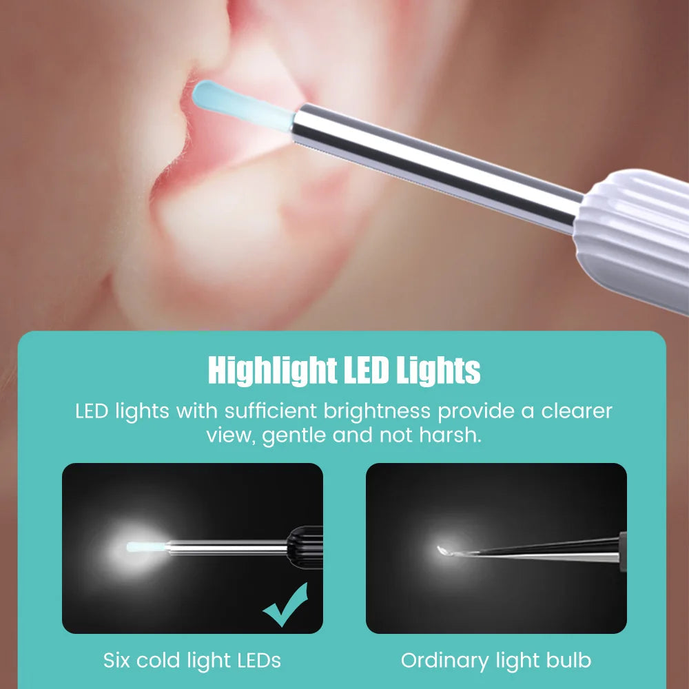 Smart Visual Earpick Ear Wax Removal Tool Endoscope Spoon 1296P HD Ear Cleaner with 6 LED Lights 3.6mm Mini Visual Ear Camera