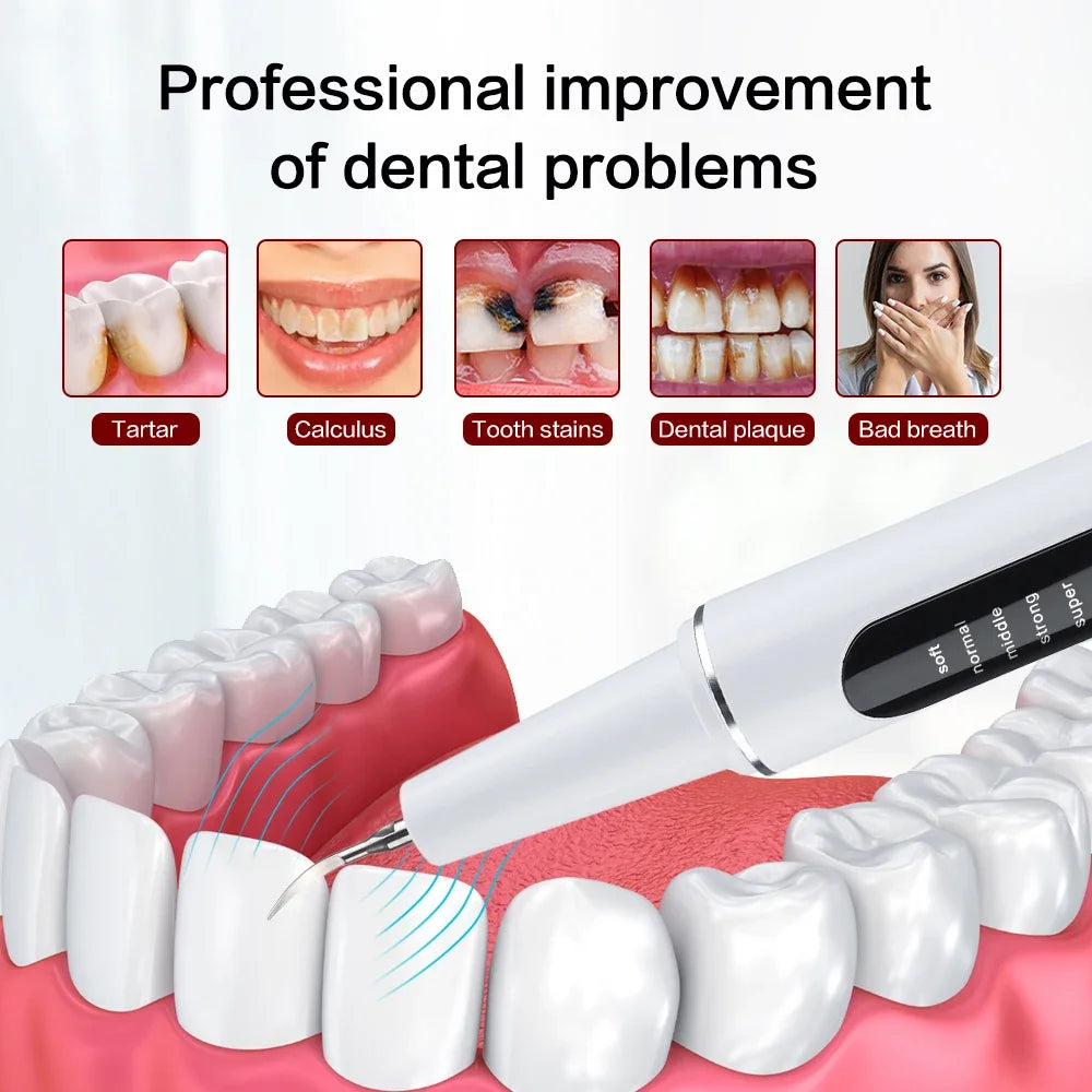 Dental Scaler Ultrasound Electric Tooth Cleaning Oral Care Plaque Removes Tartar Dental Scraper Dental Instrument