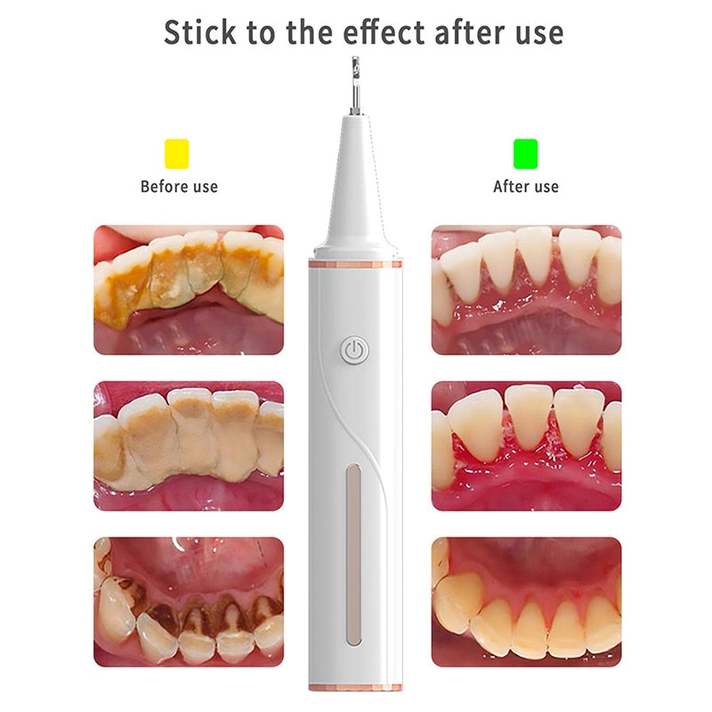 Electric Ultrasonic Dental Calculus Remover Visible Wifi Bluetooth Irrigator USB Rechargeable Teeth Whitening Scaler for Home