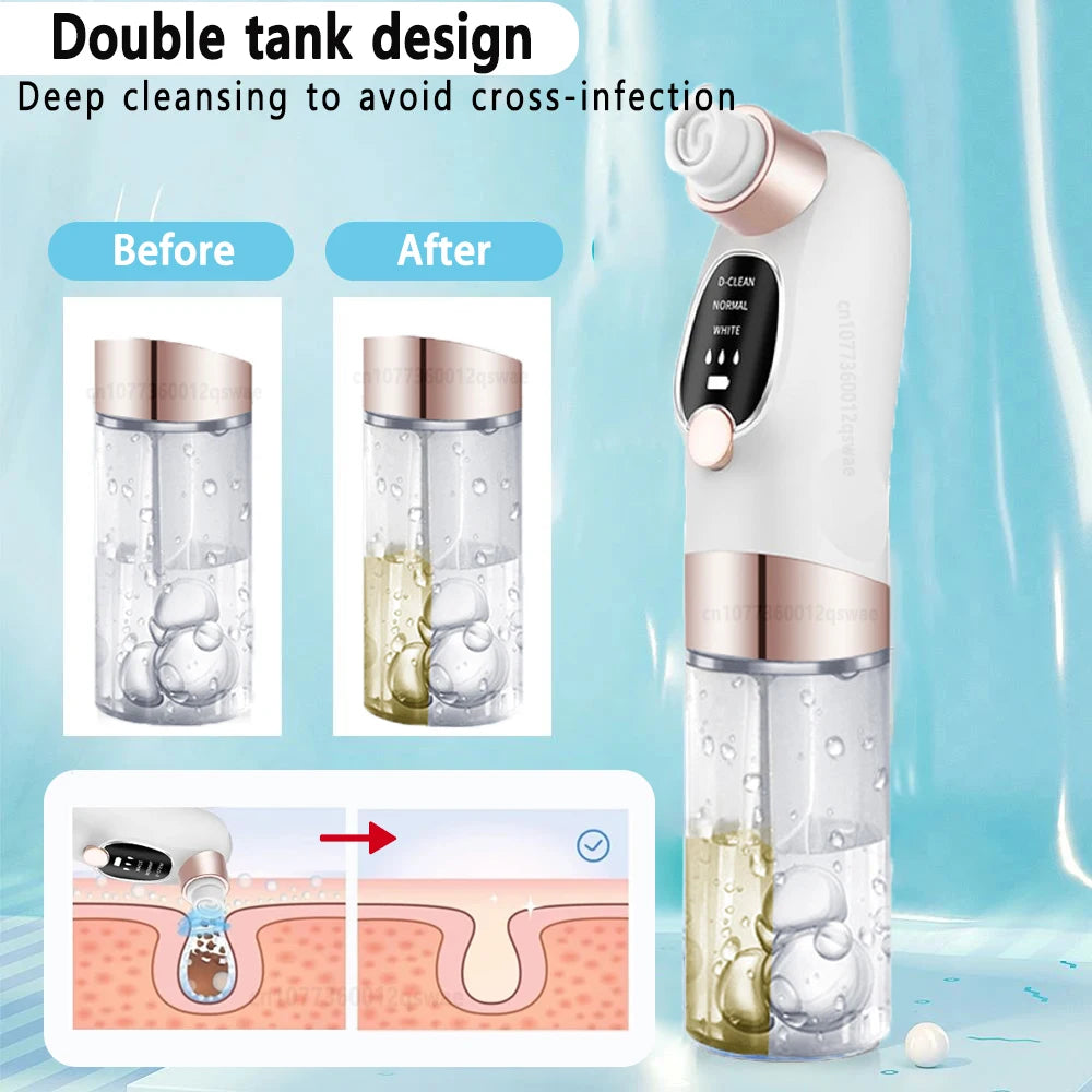 Blackhead Remover Pore Vacuum Face Nose Deep Cleaning Electric Pimple Black Head Removal Rechargeable Facial Pore Cleaner