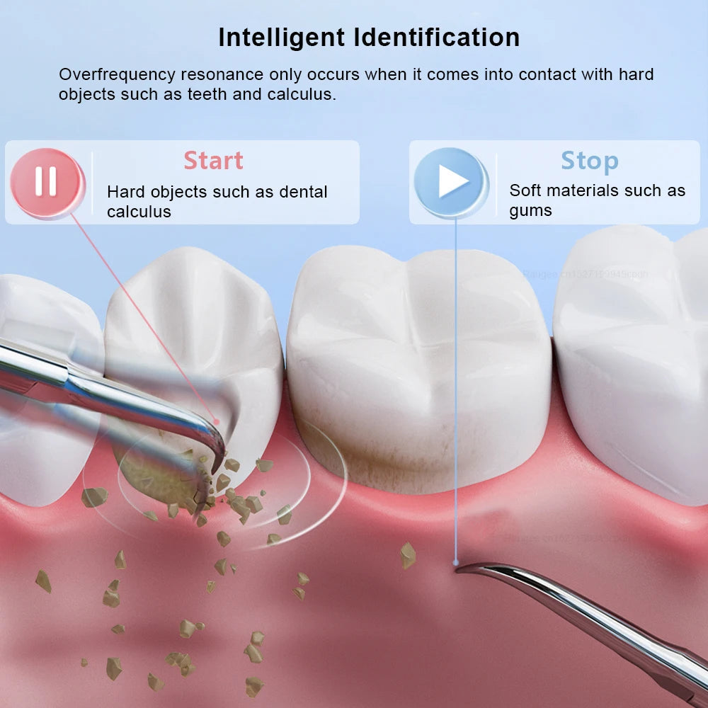 Ultrasonic Dental Tartar Cleaner Electric Tooth Polisher Tartar Eliminator Teeth Whitening Dental Calculus Plaque Tartar Remover