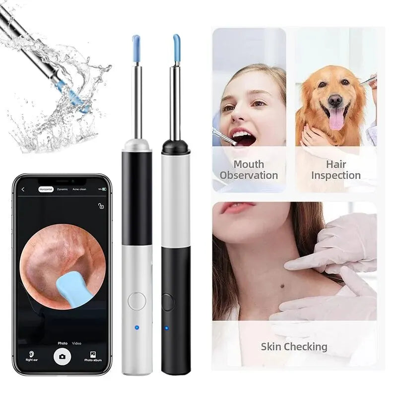 Wireless Otoscope 3.5mm Ultra-Thin WiFi Ear Scope Camera with Earwax Removal Tool Ear Cleaner with Gyroscope For IOS Android