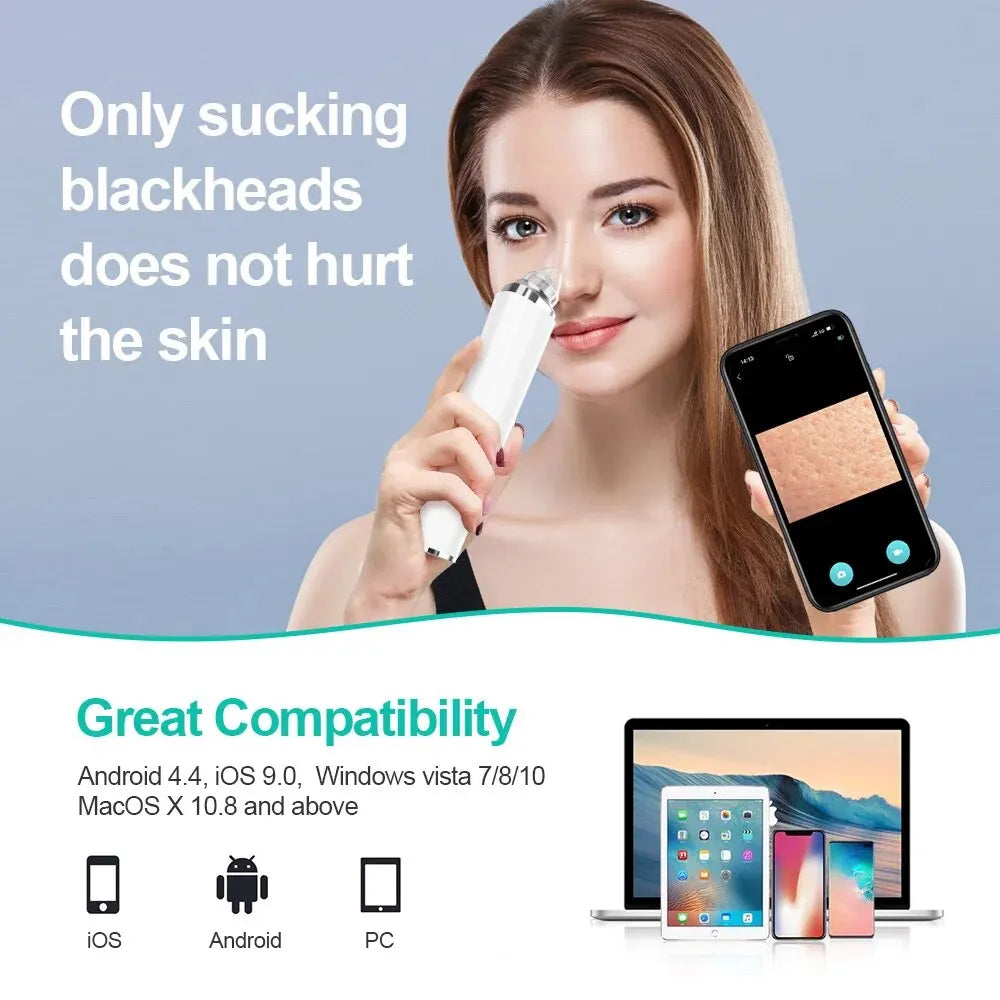 Electric Blackhead Remover Vacuum Acne Cleaner Black Spots Removal Facial Deep Cleansing Pore Cleaner Machine Skin Care Tools