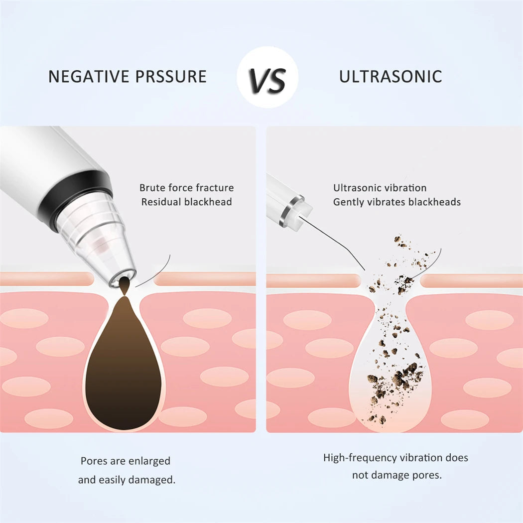 Ultrasonic Skin Scrubber EMS Vibration Ion Acne Pore Blackhead Remover Peeling Tool Electric Deep Face Cleaner