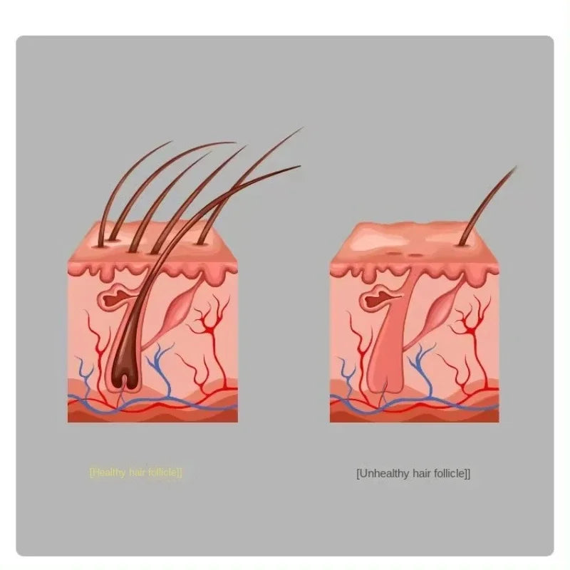 Electric Scalp Massage Comb Red and Blue Light Head Massager Hair Growth Device Healthy Hair Massage Comb