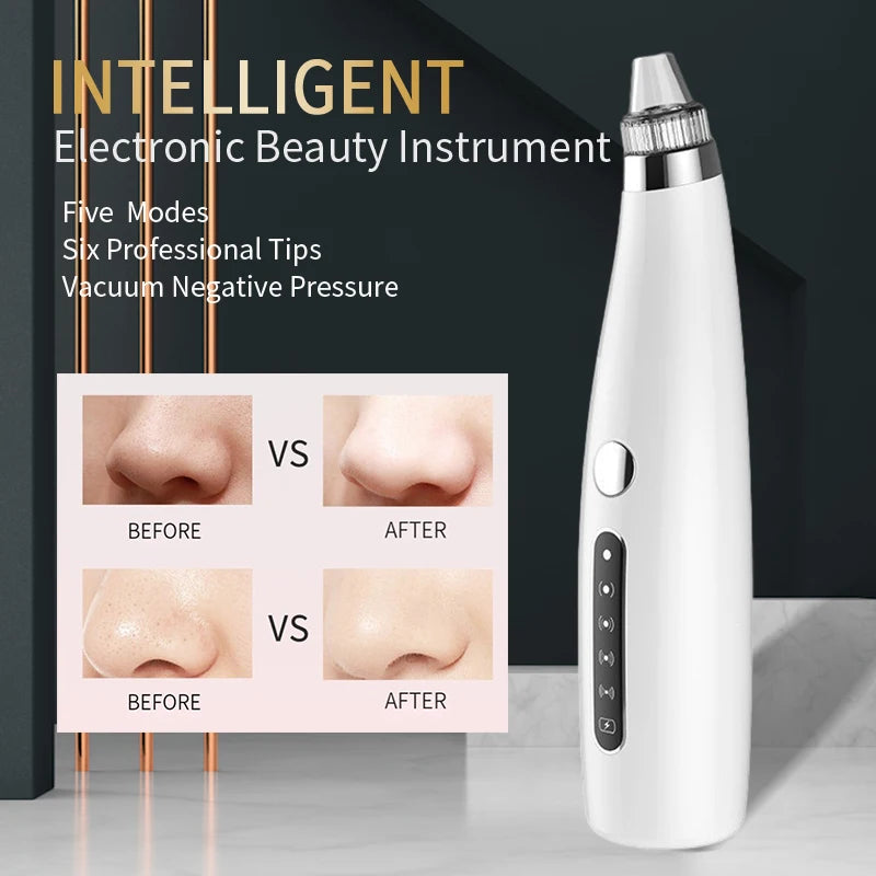 Blackhead Remover Electric Vacuum Suction Blemish Cleaner Face Care Tool Pore Nose Acne Pimple Needle Tag Removal Beauty Health